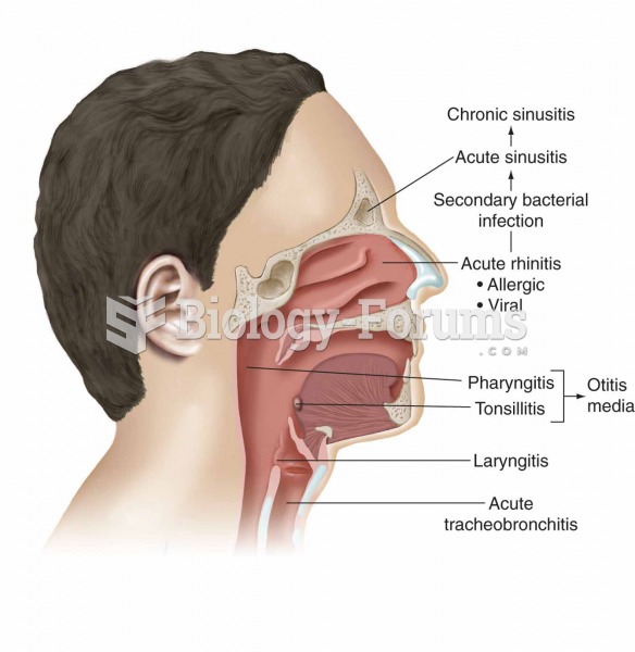 Paranasal sinuses are part of the upper respiratory system.