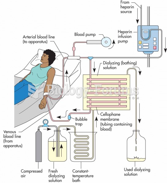 Schematic hemodialysis machine