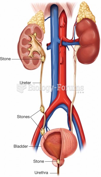 Renal calculi (stones) can form in several areas within the urinary tract. When they form in the kid