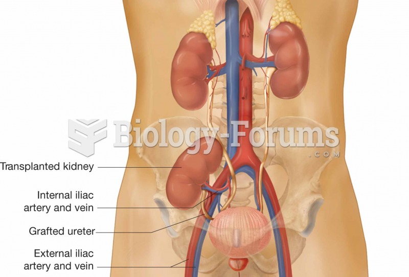 Placement of transplanted kidney.