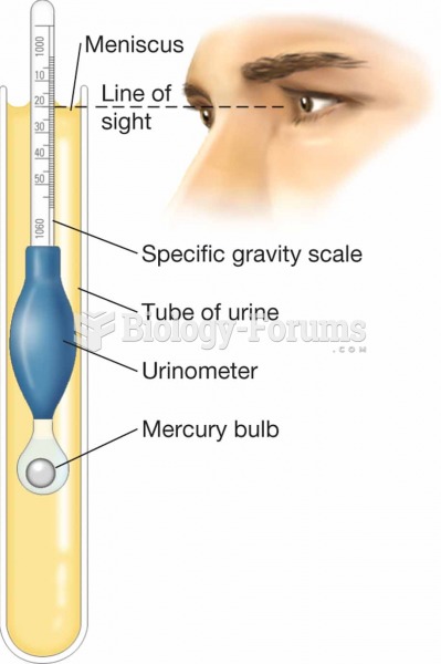 Urinometer. In this procedure, a urine sample and urinometer are placed within a tube, and the liqui