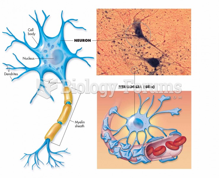 Two main types of nerve cells.