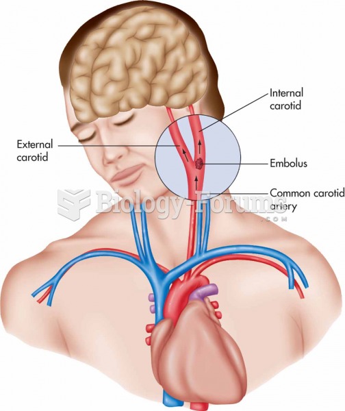 Embolus traveling to the brain.