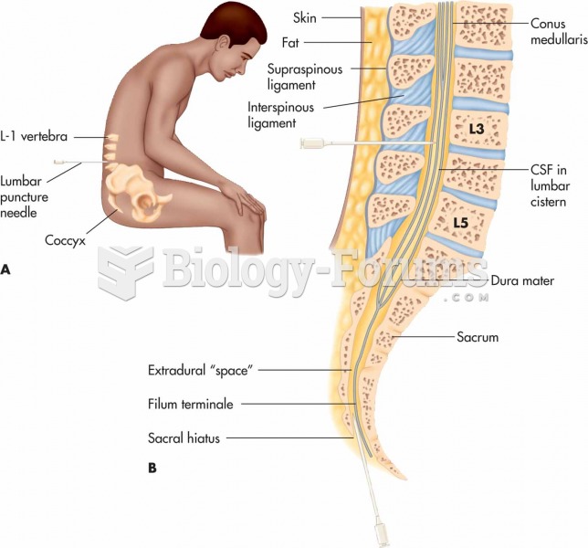 (A) Lumbar puncture, also known as spinal tap; (B) section of the vertebral column showing the spina