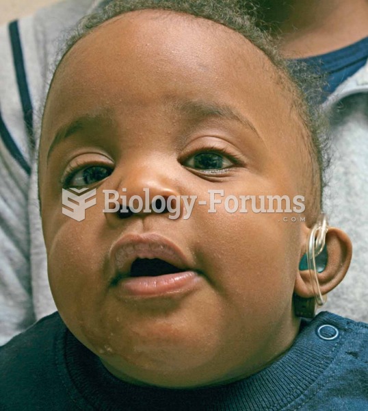 A child with a hearing impairment wears a hearing aid (as noted in his left ear).