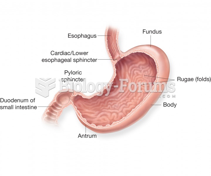 The stomach. Longitudinal view showing regions and internal structures. 