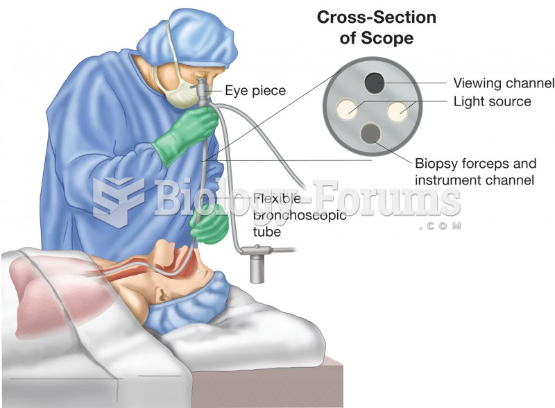Bronchoscopy. Figure illustrates physician using a bronchoscope to inspect the patient’s bronchial t