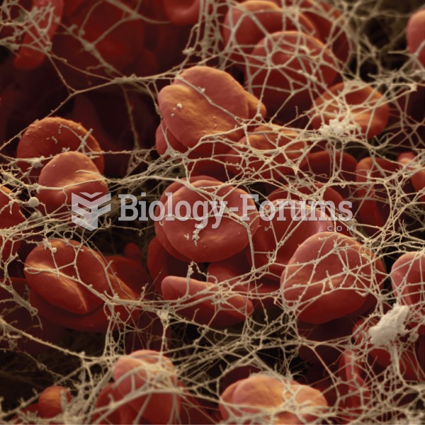Electronmicrograph showing a blood clot composed of fibrin, red blood cells, and tissue debris. 
