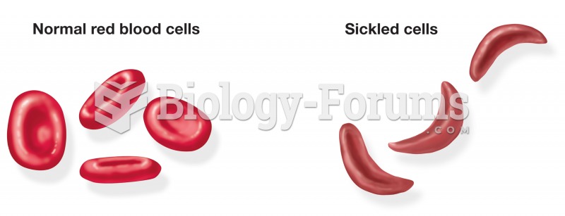 Comparison of normal-shaped erythro- cytes and the abnormal sickle shape noted in patients with sick