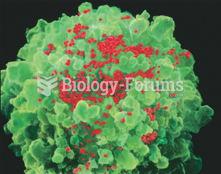 Color-enhanced scanning electron micrograph of HIV virus (red) infecting T-helper cells (green). 