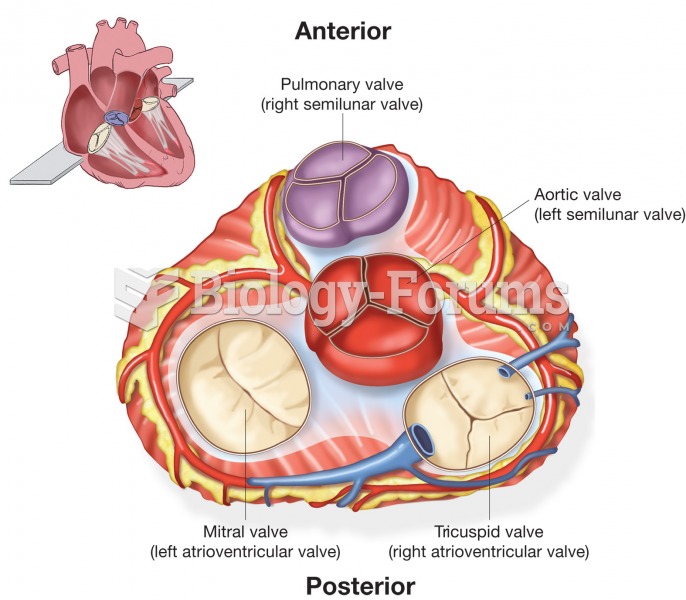 Superior view of heart valves illustrating position, size, and shape of each valve. 