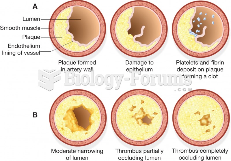 Development of an atherosclerotic plaque that progressively narrows the lumen of an artery to the po