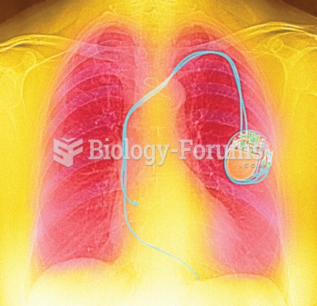 Color enhanced X-ray showing a pacemaker implanted in the left side of the chest and the electrode w