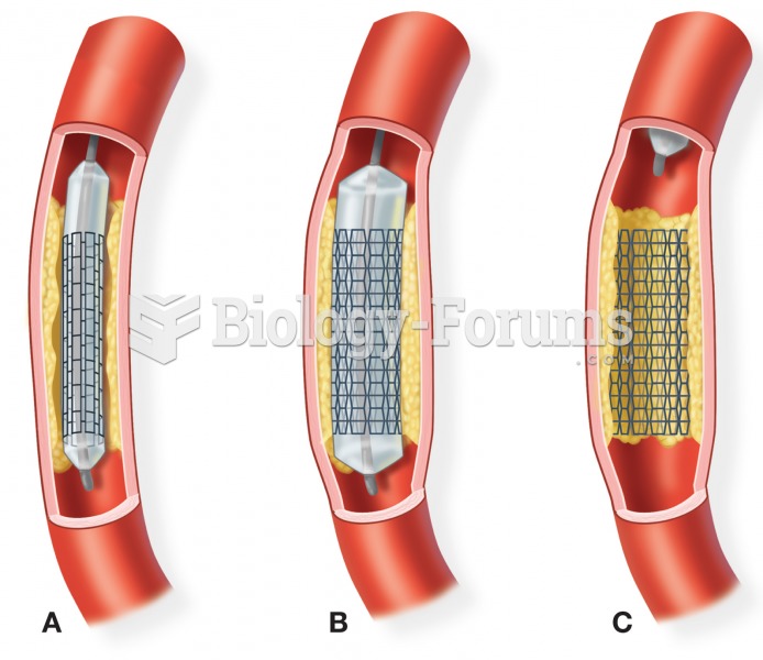 The process of placing a stent in a blood vessel. (A) A catheter is used to place a collapsed stent 