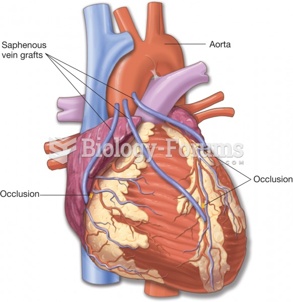 Coronary artery bypass graft (CABG). The grafts are often obtained from the patient’s saphenous vein