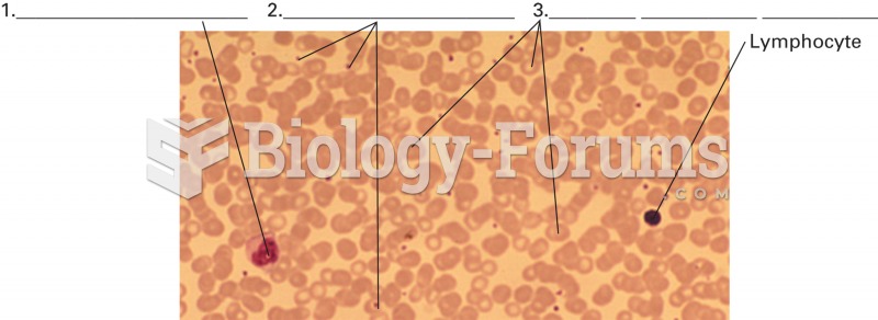 A blood smear. The smear reveals representative cells from each formed element group: red blood cell