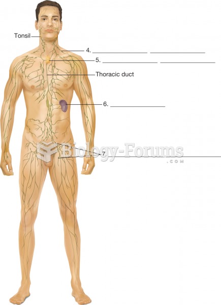 The lymphatic system. Lymphatic vessels, major lymph nodes, and lymphatic organs. The direction of l