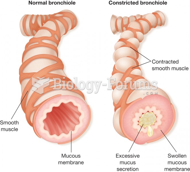 Asthma. (a) A normal bronchiole. (b) An asthmatic bronchiole. During an asthma “attack,” the bronchi