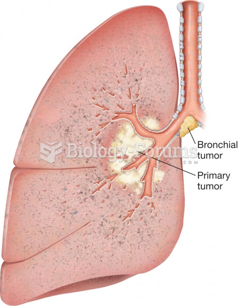 Bronchogenic carcinoma. An illustration of a sectioned lung that contains tumors associated with a b