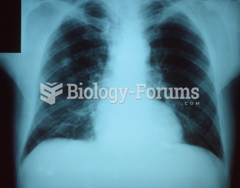 Pneumonia. This common lung inflammation may be caused by bacteria, viruses, or fungi and is often d