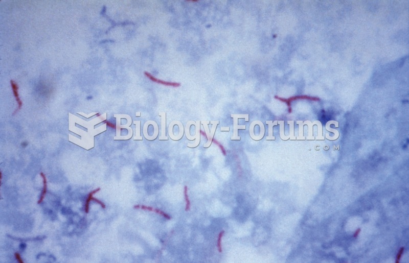 Tuberculosis. Microphotograph of the Mycobacterium tuberculosis, the cause of the disease TB.  