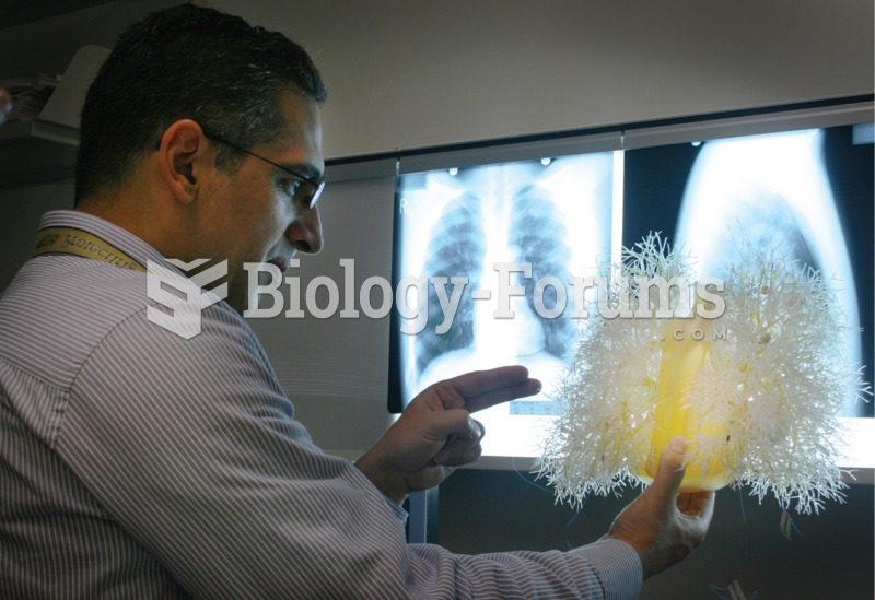 Chest X-ray. A physician is examining chest X-rays with the aid of a plastic model of the bronchial 