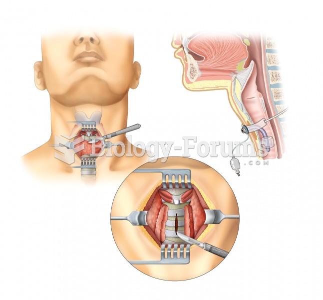 Tracheostomy. A tracheotomy, or incision into the trachea, is performed to create an opening into th