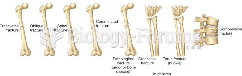 Common bone fractures.