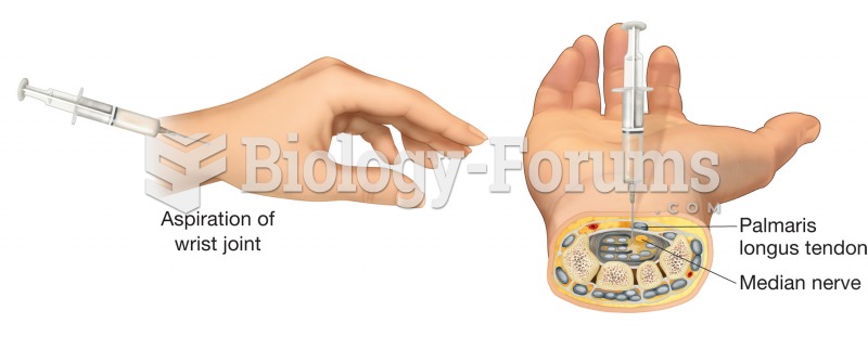 Arthrocentesis. The aspiration of fluid is a common treatment for joint injuries resulting in inflam