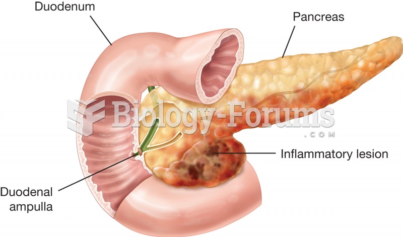 Pancreatitis. Inflammation of the pancreas may be the result of a bacterial infection, trauma, or ch