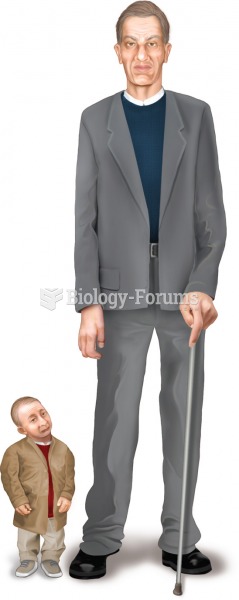 Growth hormone disorders. Illustration of a pituitary giant and a pituitary dwarf, both adults of ab