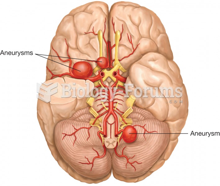 Cerebral aneurysm. A cerebral aneurysm is the abnormal dilation of arteries supplying the brain, whi