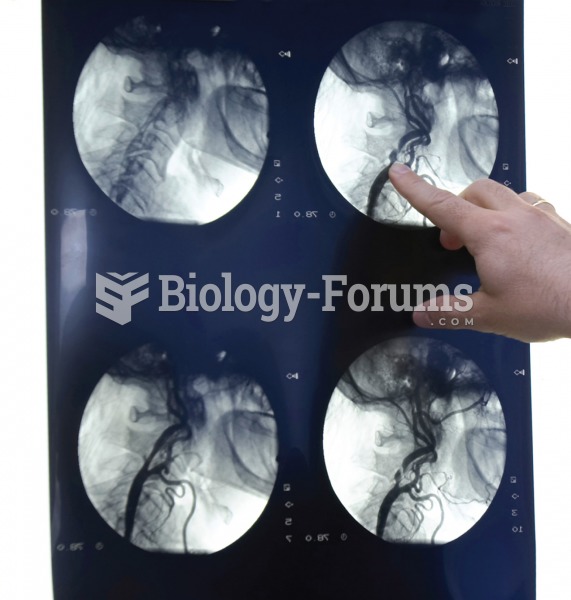 Cerebral angiography. The four angiograms each reveal the distribution of blood vessels supplying th