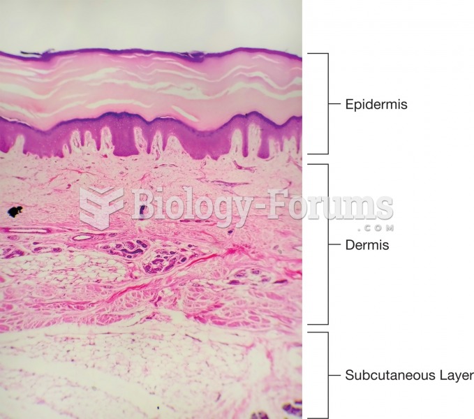 Photomicro  graph showing the three layers of the skin. 