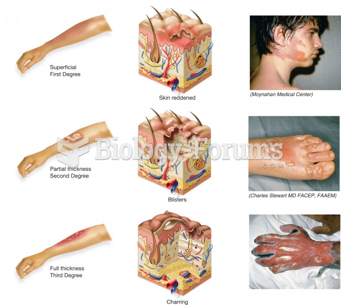 Comparison of the level of skin damage as a result of the three different degrees of burns. 