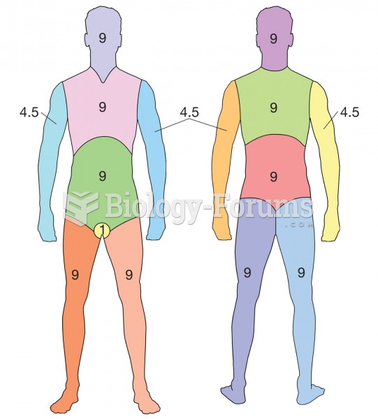 Rule of Nines. A method for determining percentage of body burned. Each different colored section re