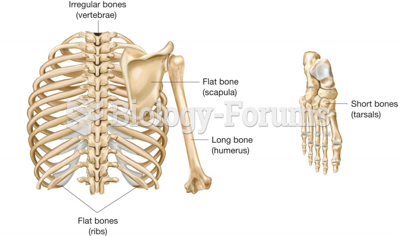 Classification of bones by shape. 