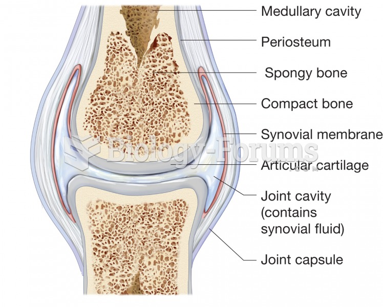 Structure of a generalized synovial joint. 