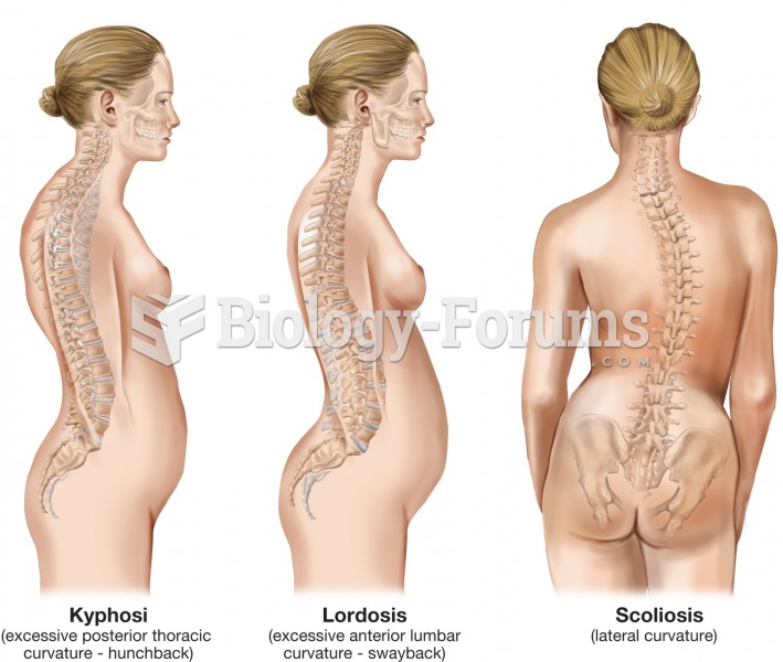 Abnormal spinal curvatures: kyphosis, lordosis, and scoliosis. 