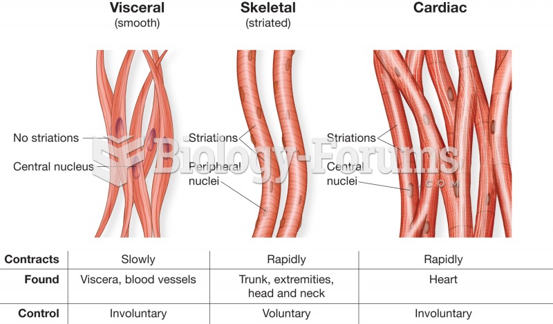 Characteristics of the three types of muscles. 