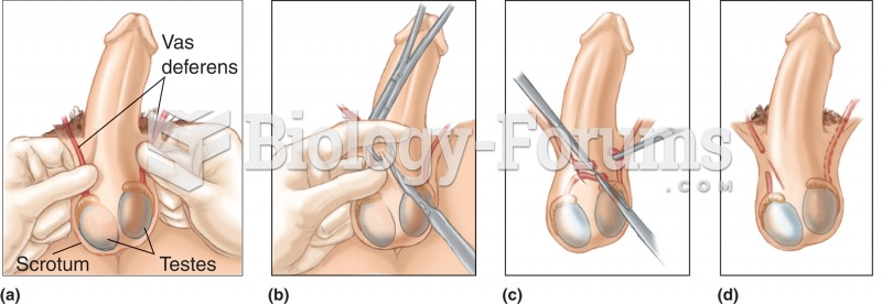 Vasectomy. (a) Vas deferens is located within the spermatic cord on both sides. (b) A small incision