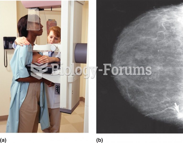 Mammography. (a) A health-care professional assists the patient to ensure the breast is placed ideal