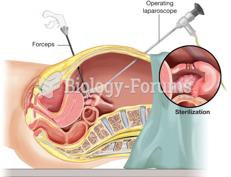 Tubal ligation. To minimize the size of the incisions necessary, laparoscopic surgery may be used to