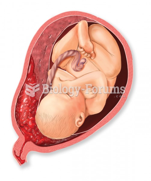 Abruptio placentae. The placenta becomes prematurely detached from the uterine wall.