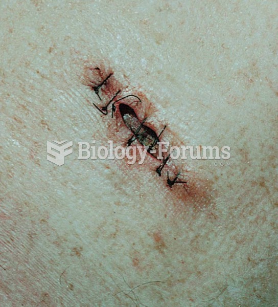 Wound dehiscence, back