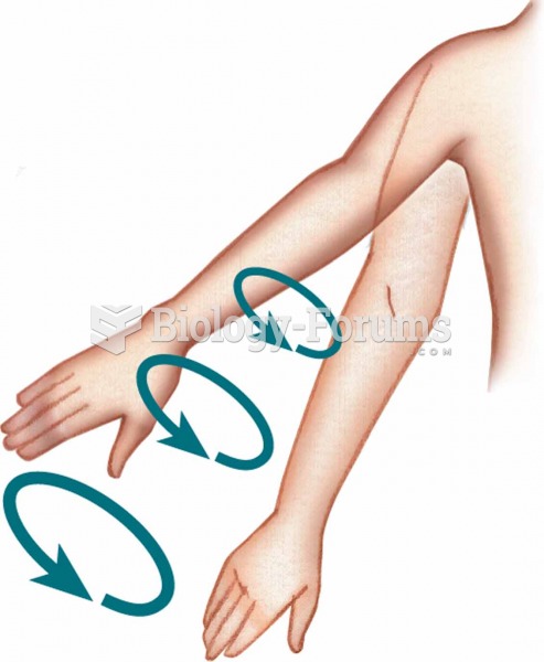 Circumduction Circumduction–Moving a body part in a circular motion.