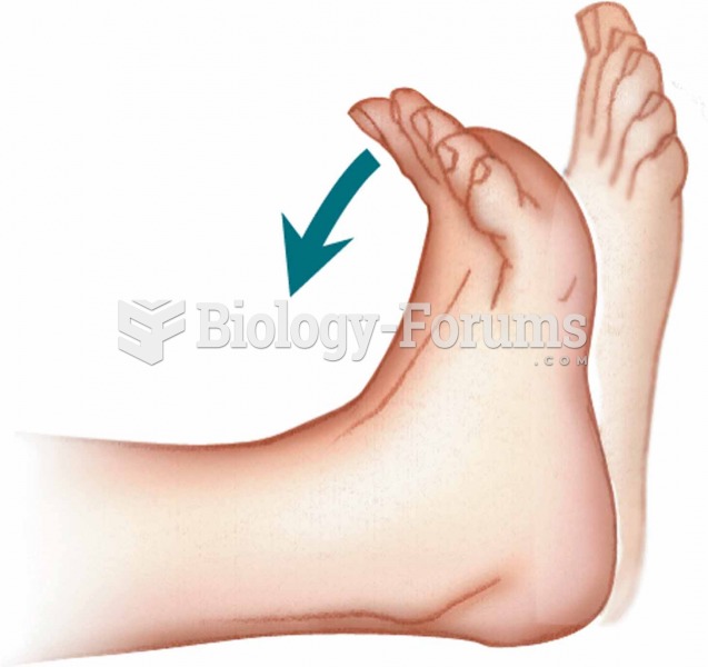 Dorsiflexion Dorsiflexion–Bending a body part backward.