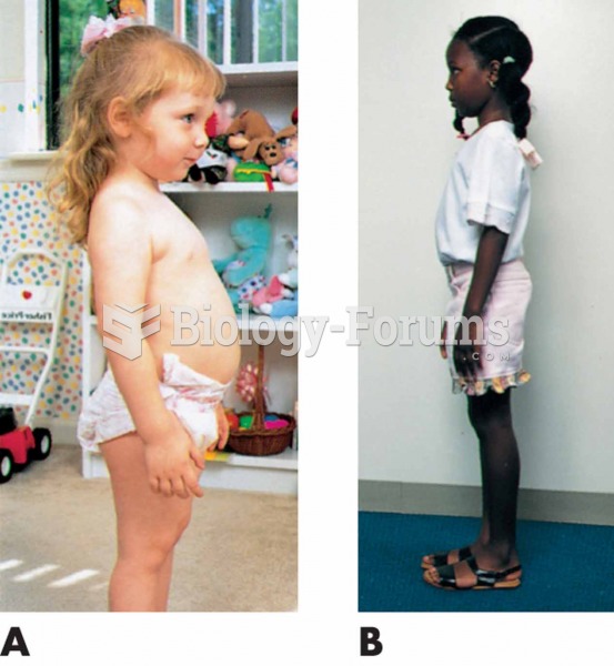 Normal development of posture and spinal curves. (A) Toddler: Protruding abdomen; lumbar lordosis. (