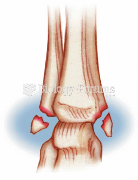 Pott’s Occurs at the ankle and affects both bones of the lower leg (fibula and tibia)