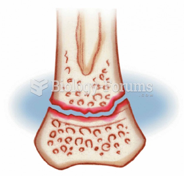 Epiphyseal Usually occurs through the growth plate where the matrix is undergoing calcification and 